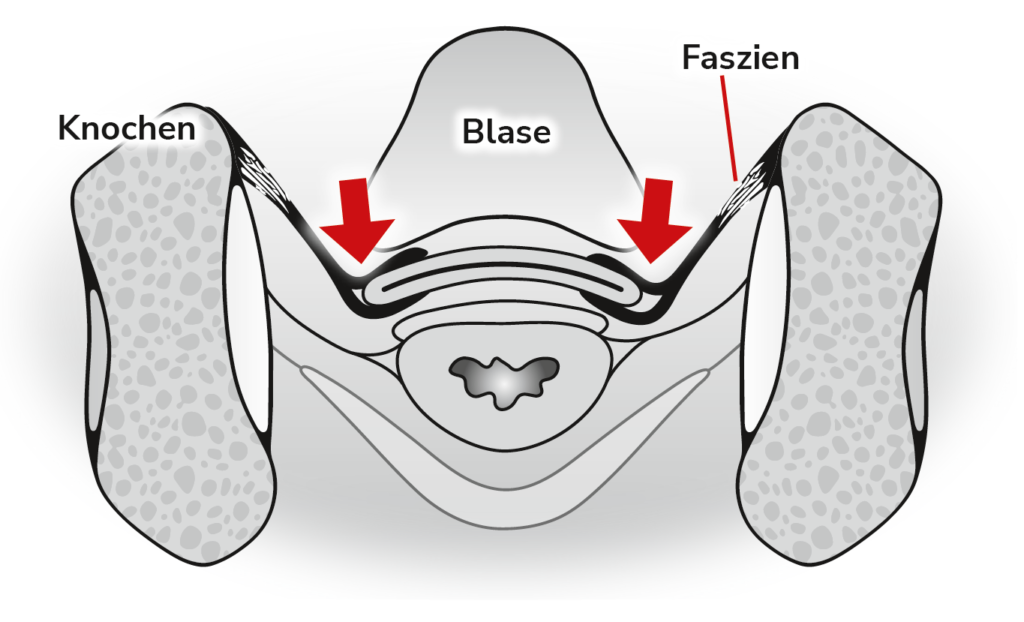 Urogynäkologie (Descensus genitalis)